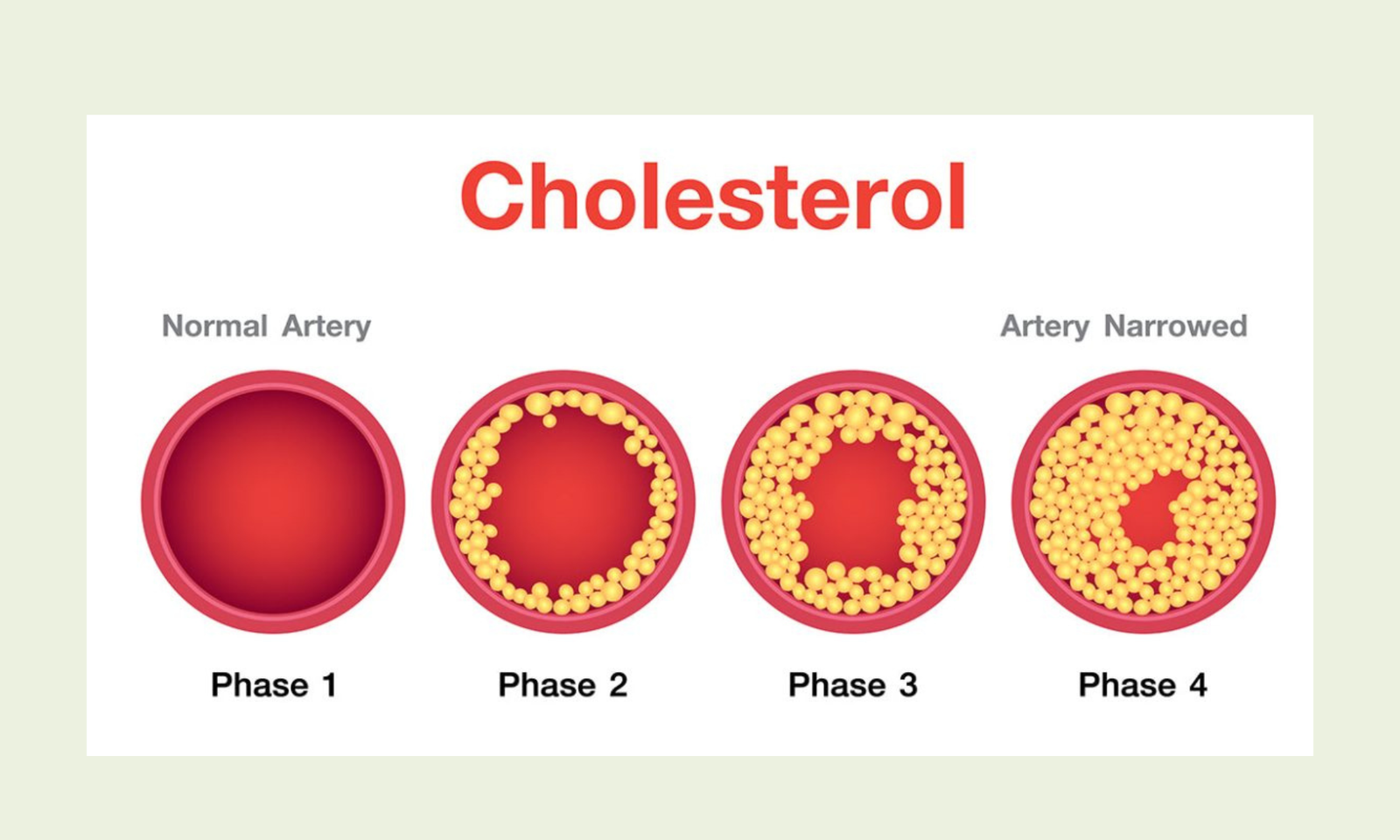 Natural Ways to Lower Your Cholesterol Levels